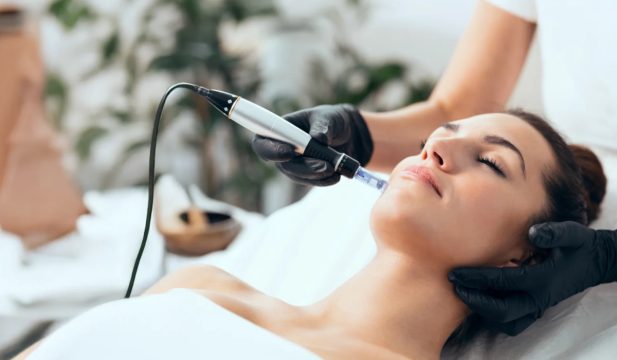 estetica-torino-microneedling