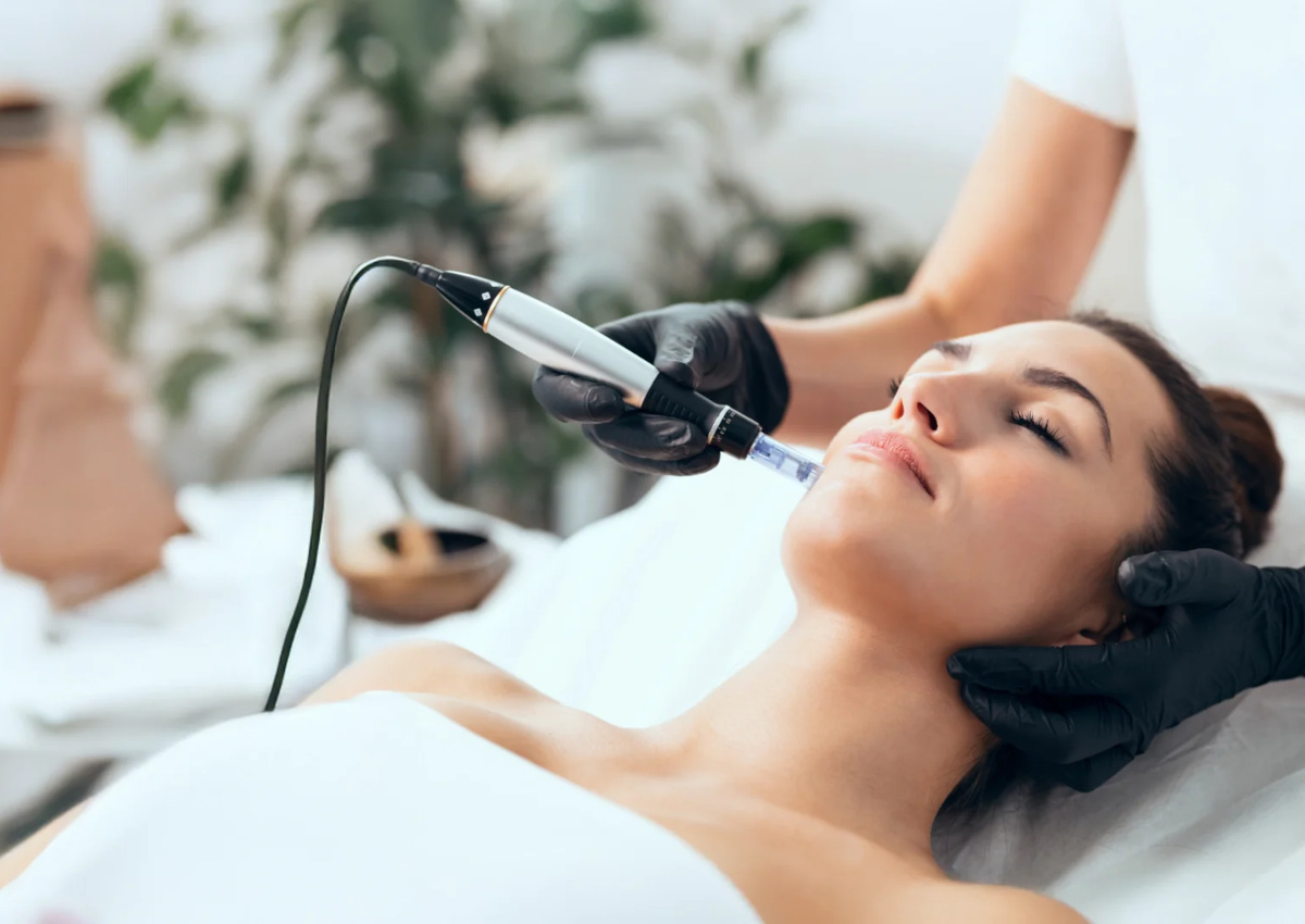 estetica-torino-microneedling